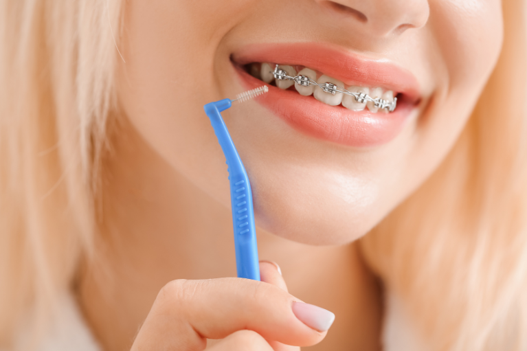 Q4. 矯正中の歯ブラシの使い方を教えてください。